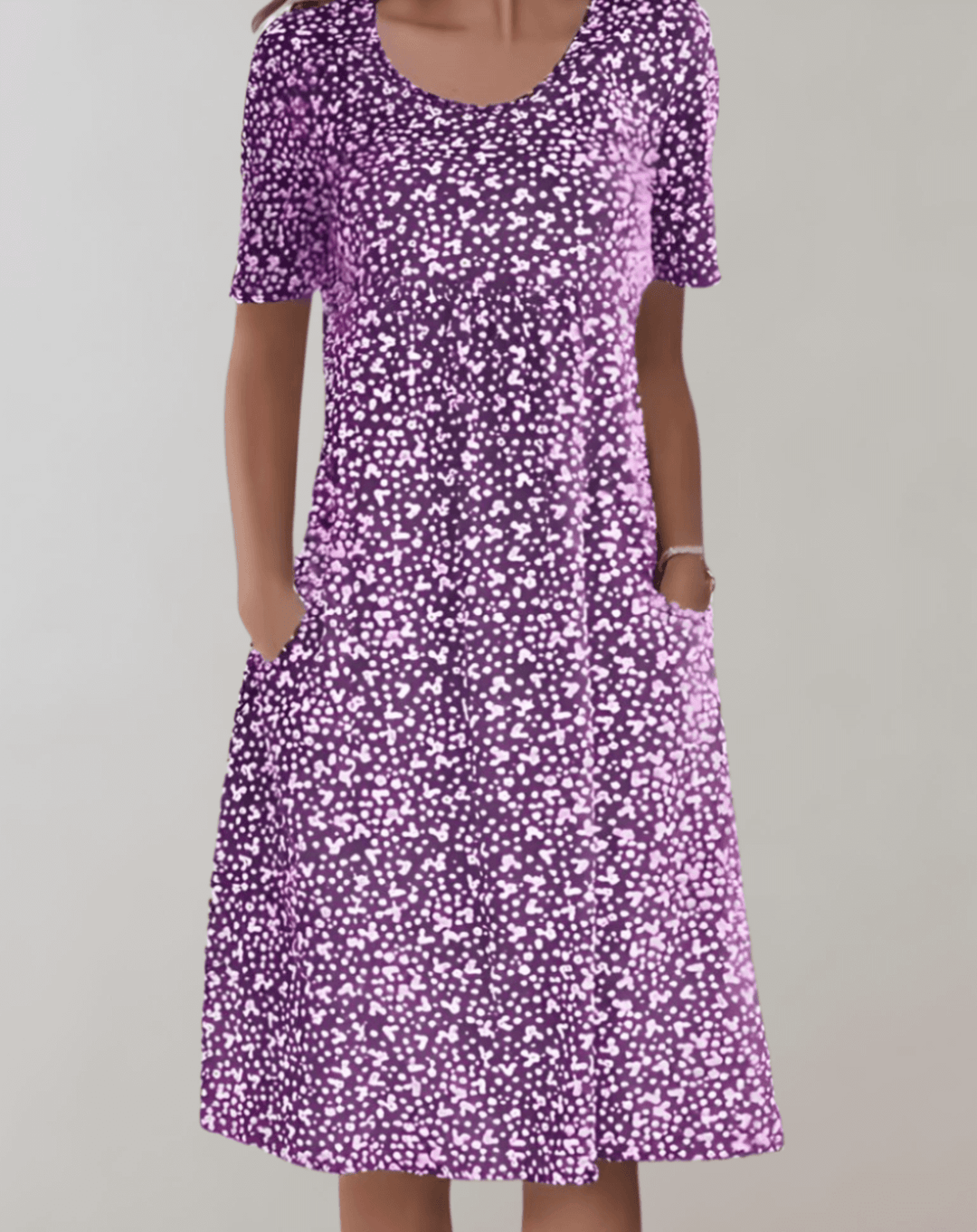 Women's Summer V-Neck Casual Dress
