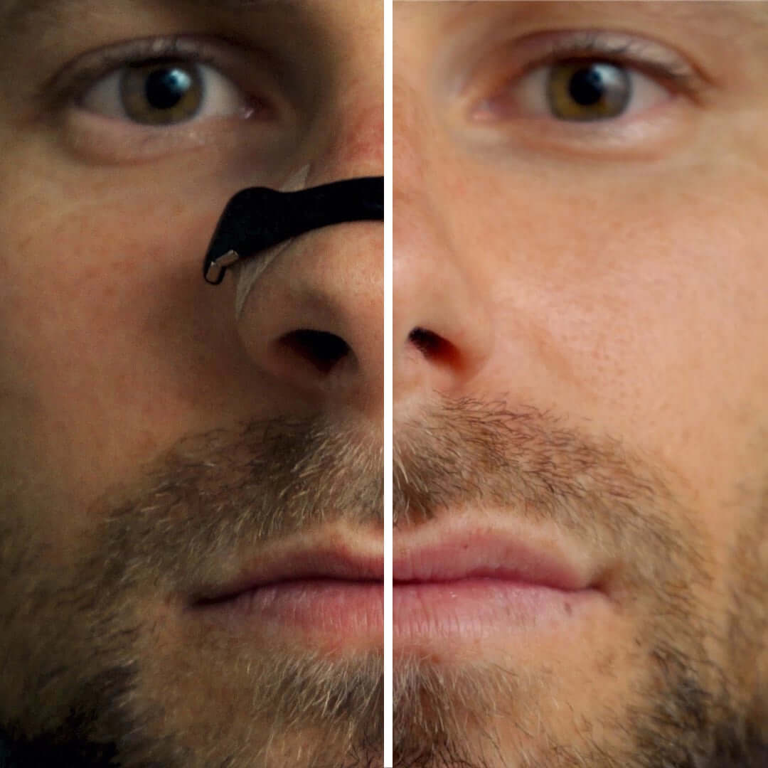 Airo Magnetic Nasal Band Kit - The New Standard for Breathing